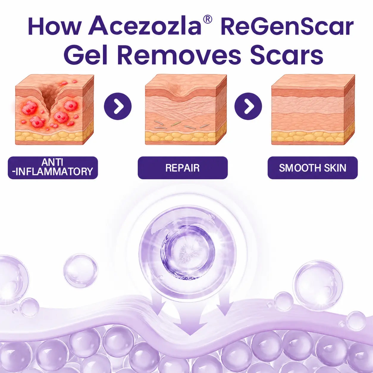 Acezozla® ReGenScar Stem Cell Scar Gel