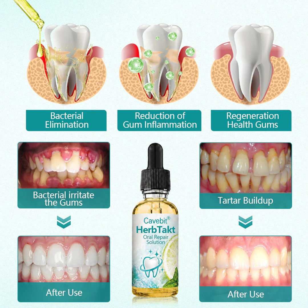 Cavebit® HerbTakt Oral Repair Solution