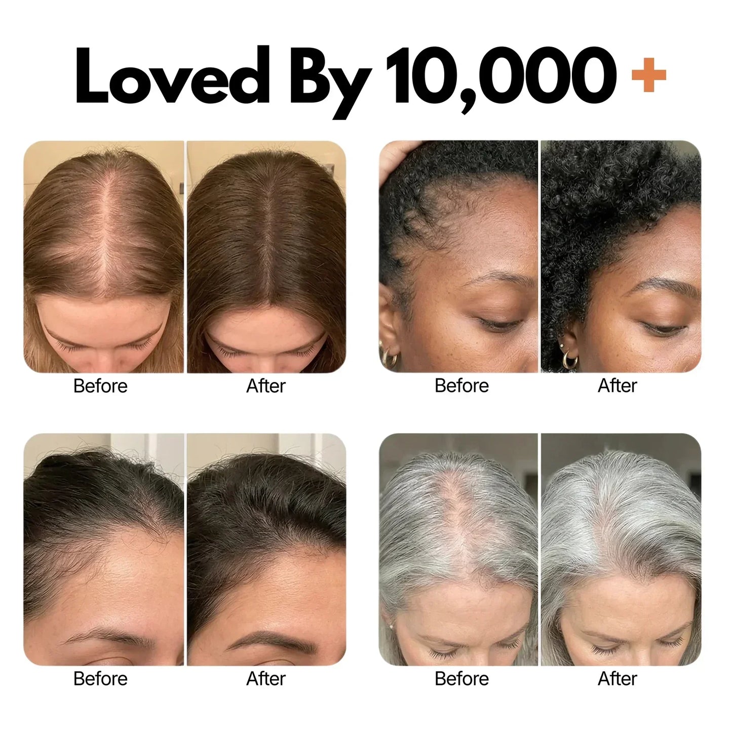 Anti‑Hair Loss Scalp Care Ampoule | 10‑Second Non‑Greasy Hair Growth Treatment With Built‑in Brush