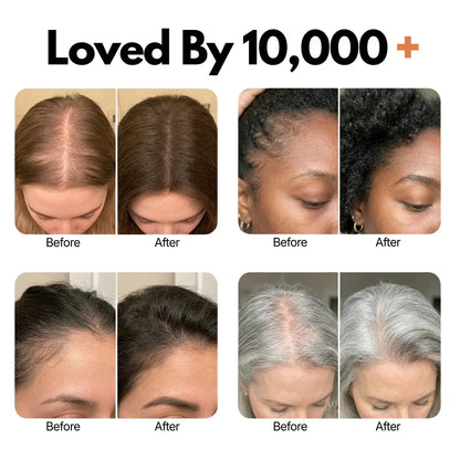 Anti‑Hair Loss Scalp Care Ampoule | 10‑Second Non‑Greasy Hair Growth Treatment With Built‑in Brush