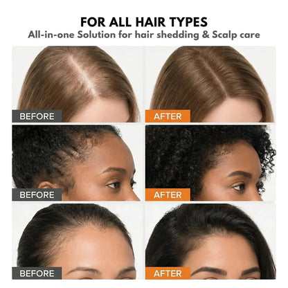 Anti‑Hair Loss Scalp Care Ampoule | 10‑Second Non‑Greasy Hair Growth Treatment With Built‑in Brush