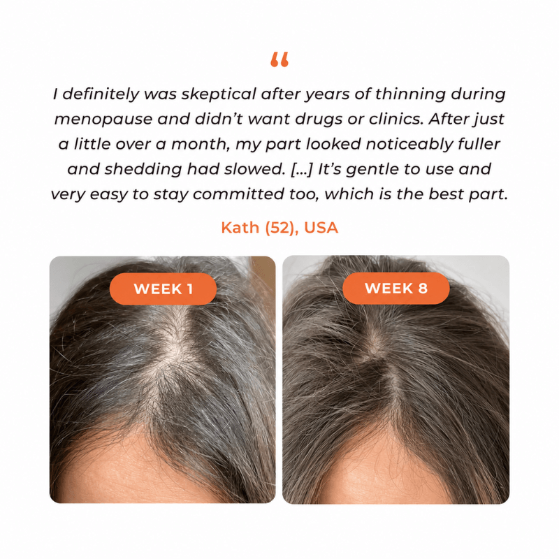 Anti‑Hair Loss Scalp Care Ampoule | 10‑Second Non‑Greasy Hair Growth Treatment With Built‑in Brush