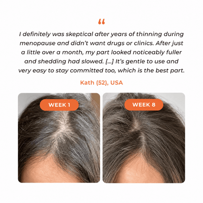 Anti‑Hair Loss Scalp Care Ampoule | 10‑Second Non‑Greasy Hair Growth Treatment With Built‑in Brush